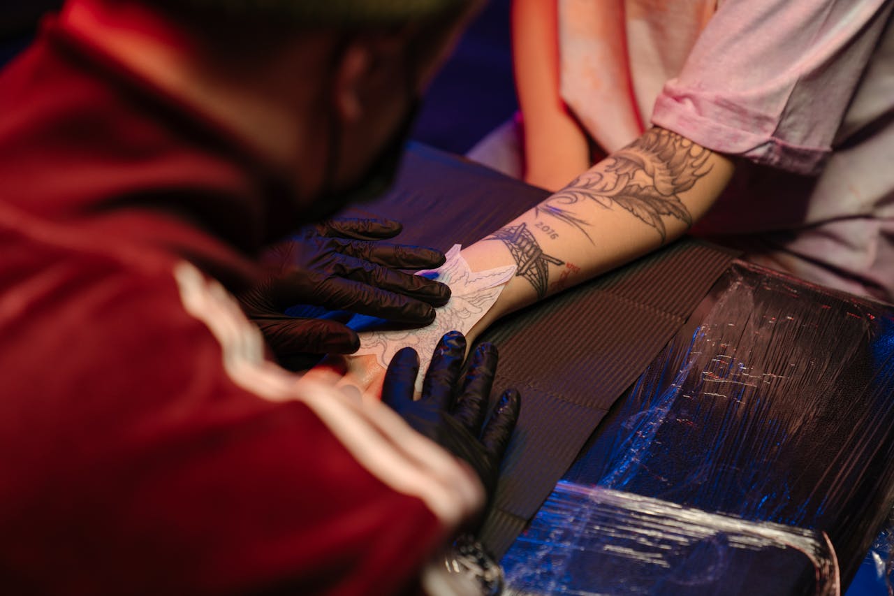 Dövmeyi Silme Süreci